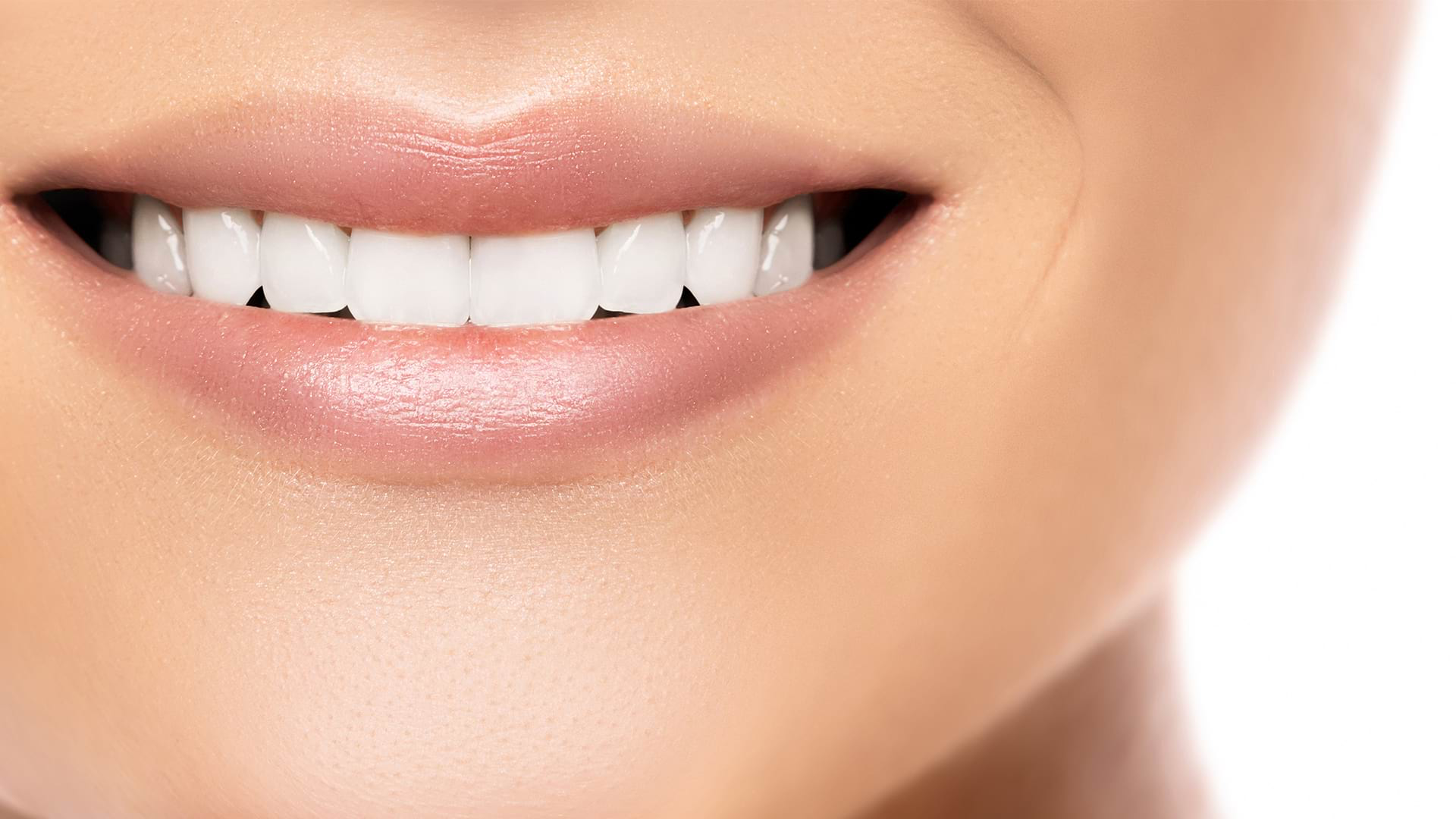 Metal Substructure and Porcelain